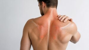 Omuz ve Sırtta Kulunç Neden Olur? Nasıl Geçer?